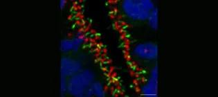 Immunostaining of a cortical organoid revealing primary cilia protruding from the surface of neural stem cells.