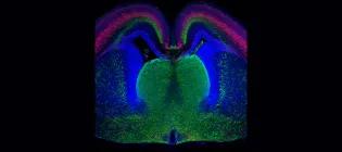 Section through the front part of an embryonic brain with different cell types labelled different colours.