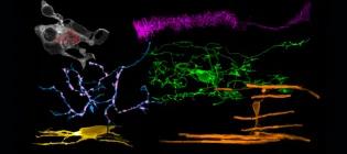 Brain cell diversity: neurons (blue), synapses (red), oligodendroglia (green, yellow, orange), microglia (white), astroglia (magenta).