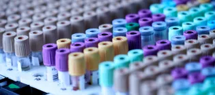 rows of blood test tubes in a rack
