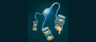 illustration of oligodendrocyte providing myelin to protect nerve cells