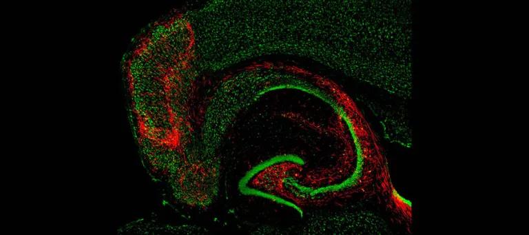 Septal Projections to the Hippocampus which are critical in circuits generating seizures in temporal lobe epilepsy.