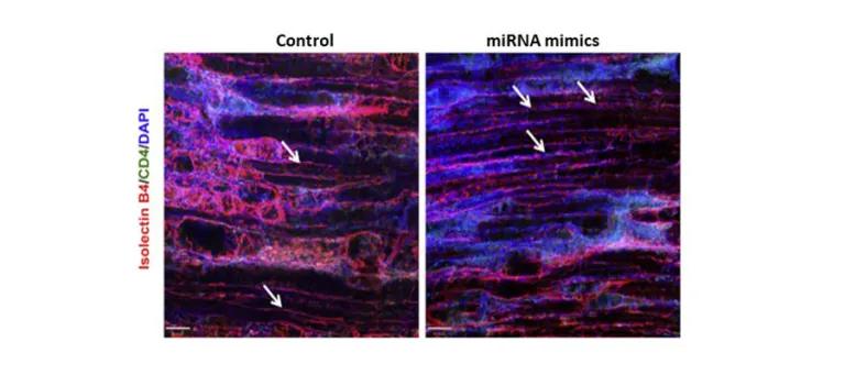 miRNA mimics preserve the native microvasculature network following ischaemic injury