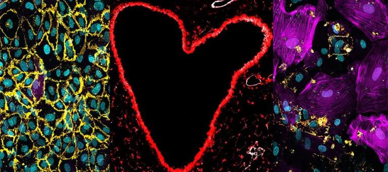 Visualising the vasculature in health and disease