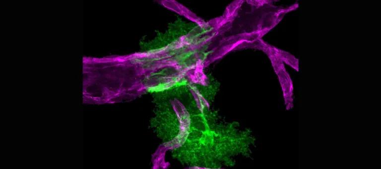 Two astrocytes in green enwrapping brain blood vessels in magenta.