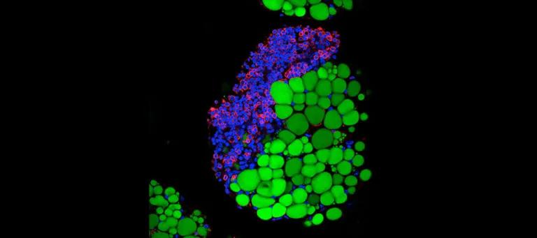 Immune cells (red and blue) clustering on fat cells (green)