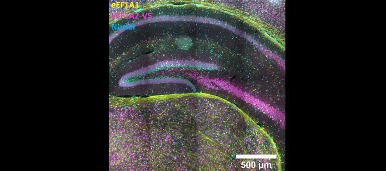 A section through hippocampus showing non-overlapping expression of eEF1A1 and eEF1A2