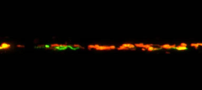 Axonal Responses of Mitochondria to Demyelination - ARMD - as evident by the abundant transport of mitochondria from the cell body to the axon (green) upon demyelination'.