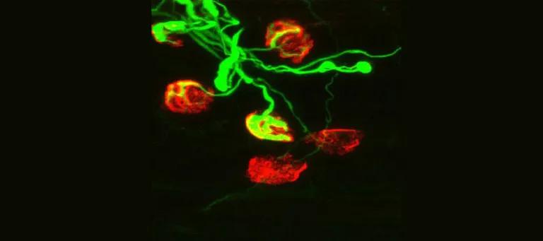 Neuromuscular junctions from a mouse model of motor neuron disease showing degeneration.