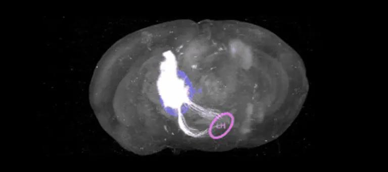 GFP labelled neurons in the prefrontal cortex send long-range axons to the lateral hypothalamus (LH).