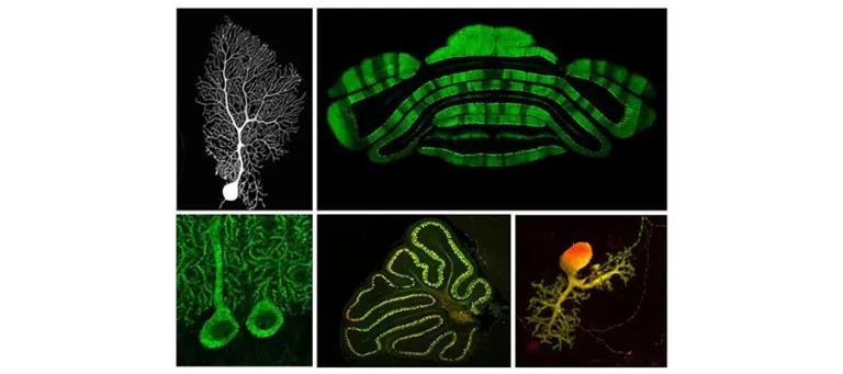 Images of the cerebellum and Purkinje cells, the principal neuron of the cerebellar cortex.