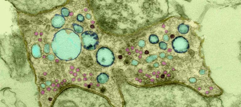 The false colour image reveals a presynapse after activity, with neurotransmitter-containing SVs (pink) and endosomes formed by endocytosis (blue). 