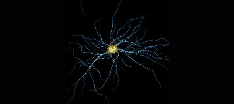 Rat hippocampal neuron at 14 days in vitro (DIV): Camk2a mRNA (orange), MAP2 (cyan).