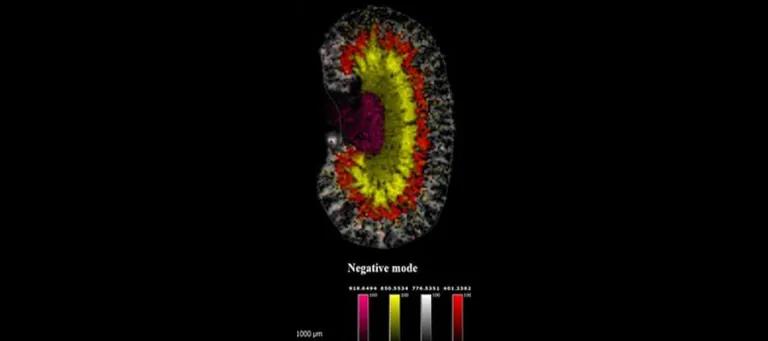 Mass spectrometry image of glucocorticoid and mineralocorticoid hormones that control blood pressure aligned to kidney regions
