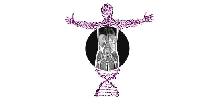 Using machine learning to analyse MRI scans, we have measured bone marrow fat in >50,000 people, thereby revealing how it impacts human health