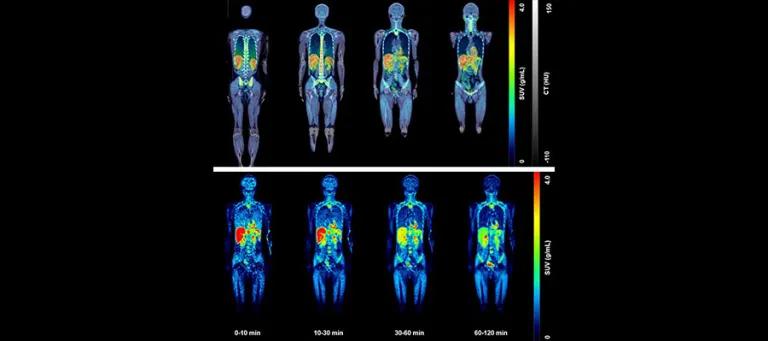 First healthy human whole-body images of [18F]LW223, a new imaging marker of inflammation. Data published in the EJNMMI.