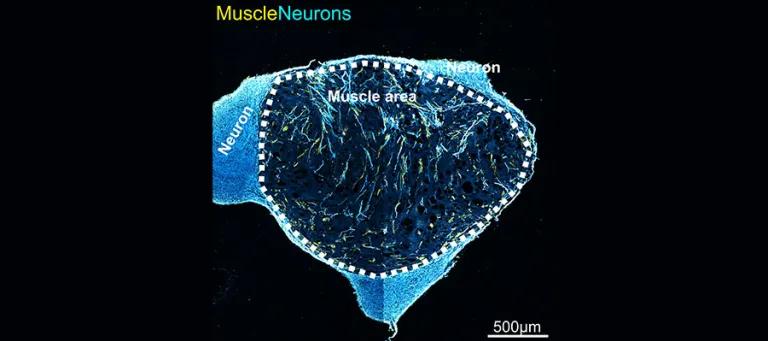 Human Stem cell derived neuromuscular organoids.