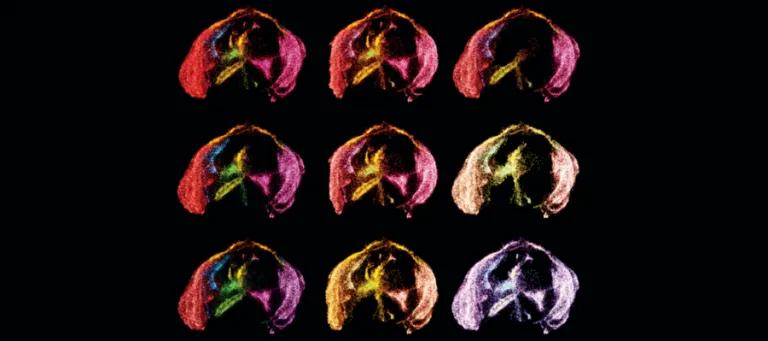 Modified versions of a graphical representation of data from developing brain cells.