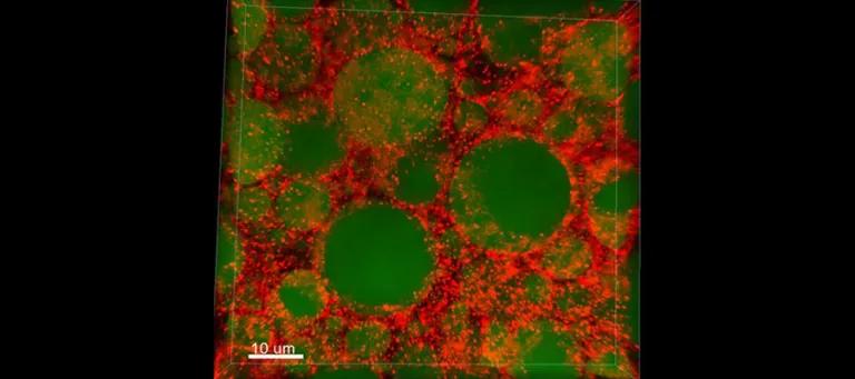 Fat body, the fly equivalent of the mammalian liver and adipose tissue, with lipid droplets in green and the ALS8 protein in red.