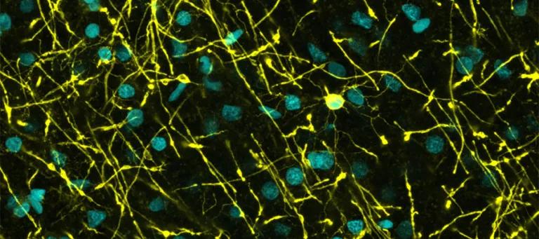 We study how myelin shapes developing brain networks and whether targeting myelin can restore healthy communication in neurodevelopmental disorders.