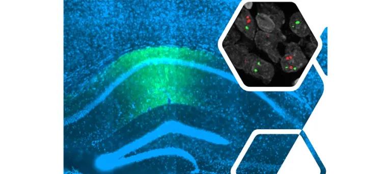 We use genetic, pharmacological, and imaging tools to study brain (e.g. hippocampus, main image, with cell markers, inset) and cognition.