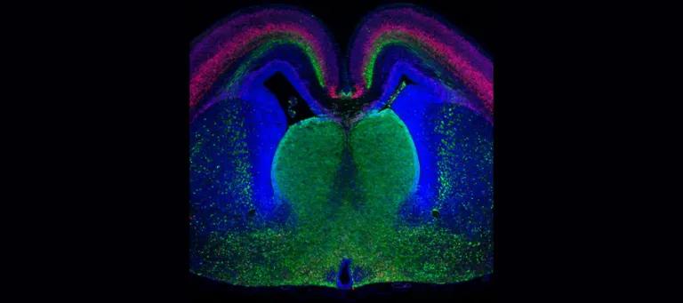 Section through the front part of an embryonic brain with different cell types labelled different colours.