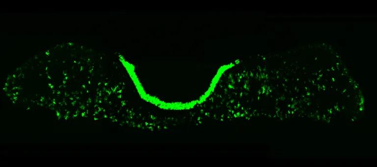 Image of a mouse pituitary where cells producing the stress hormone ACTH are marked in green.