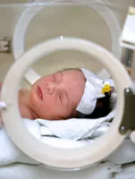 Premature baby in an incubator