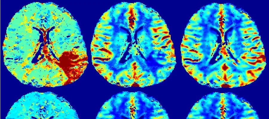 The Brain Research Imaging Centre (BRIC)