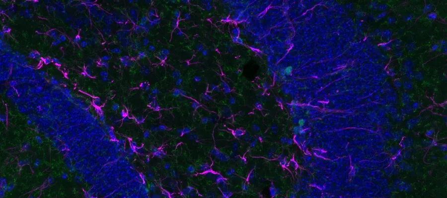 Confocal image of the hippocampus in mice 