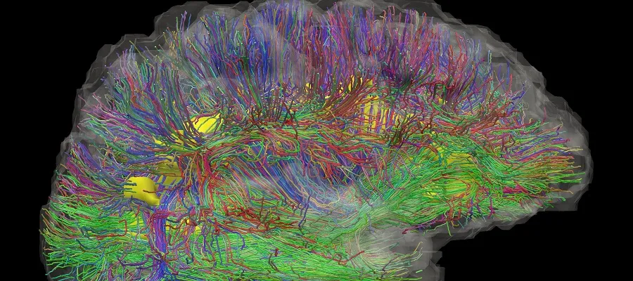 Brain white matter tracts