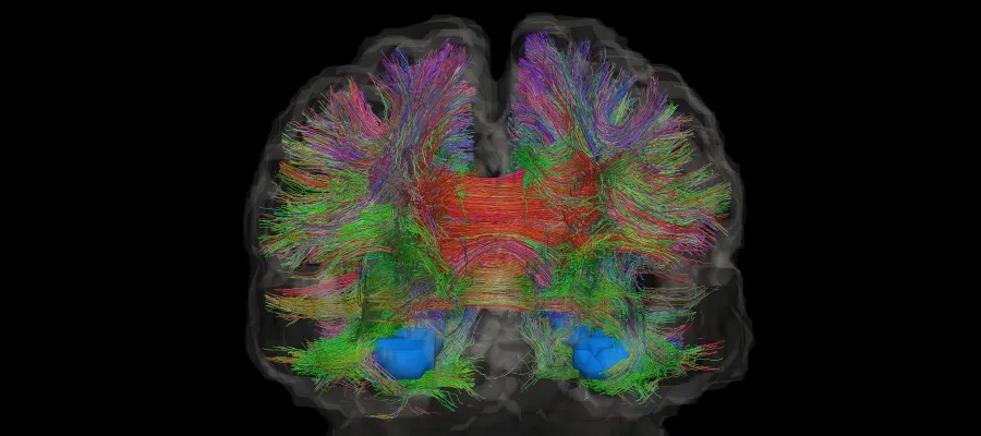 Brain scan