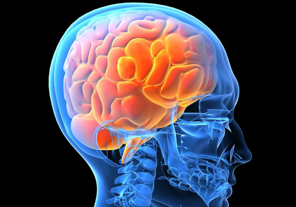 Dementia brain scan