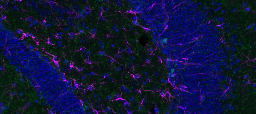 Confocal image of the hippocampus in mice 